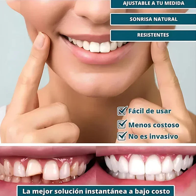 SmilePro ðŸ¦· - Carillas Dentales Ajustables De Resina + ESTUCHE REGALO - Â¡Ãšltimas unidades!