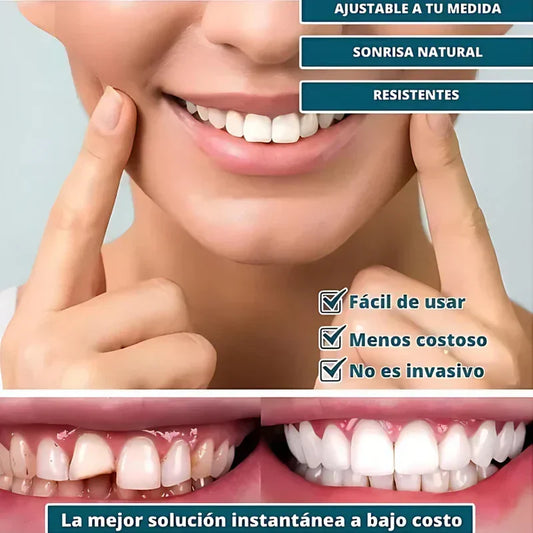 SmilePro ðŸ¦· - Carillas Dentales Ajustables De Resina + ESTUCHE REGALO - Â¡Ãšltimas unidades!