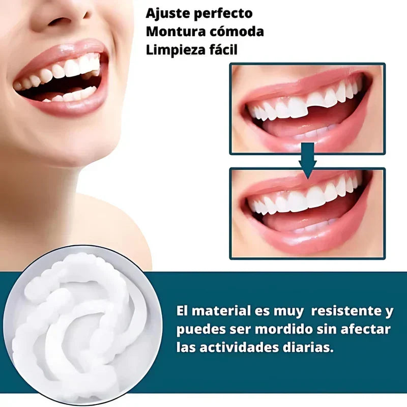 SmilePro ðŸ¦· - Carillas Dentales Ajustables De Resina + ESTUCHE REGALO - Â¡Ãšltimas unidades!