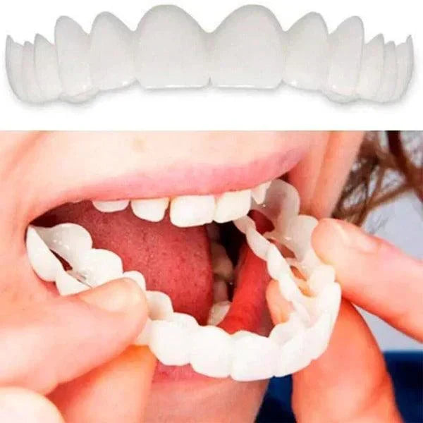 SmilePro ðŸ¦· - Carillas Dentales Ajustables De Resina + ESTUCHE REGALO - Â¡Ãšltimas unidades!